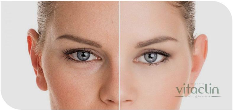 Skinbooster ®