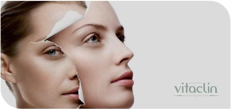 Procura Rejuvenescimento Facial? Temos 25 anos 