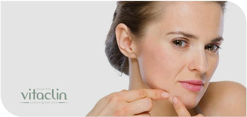 Procurando tratamento para Acne? Temos 25 anos 