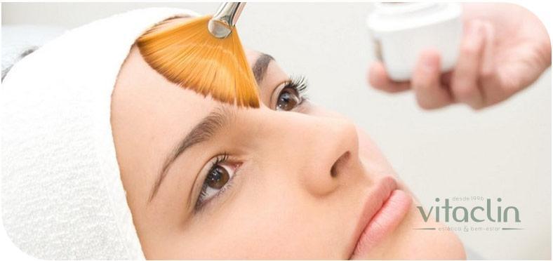 Procurando tratamento para Acne? Temos 25 anos 