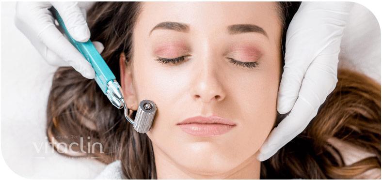 Procurando tratamento para Acne? Temos 25 anos 