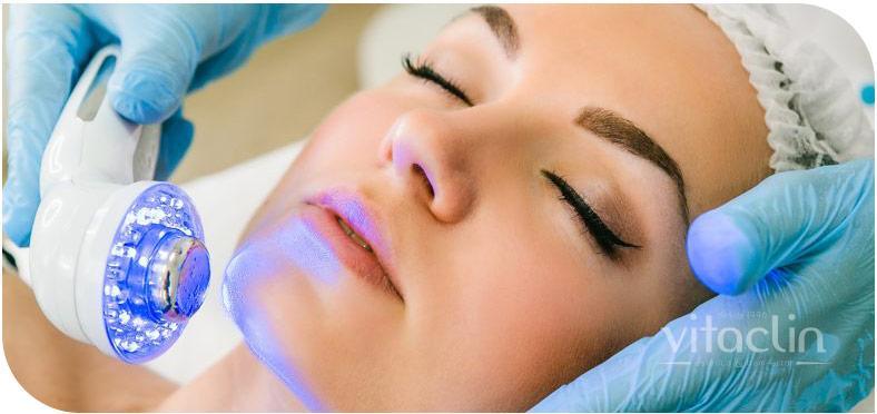 Procurando tratamento para Acne? Temos 25 anos 