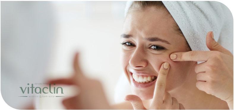 Procurando tratamento para Acne? Temos 25 anos 