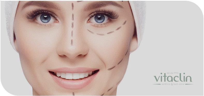 Harmonização Facial em Curitiba? Temos 25 anos